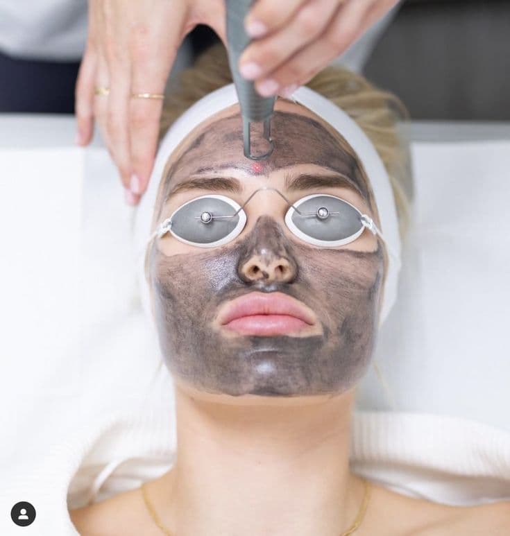 Laser De-Pigmentation