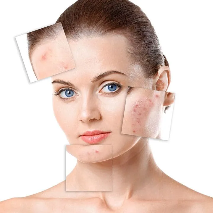 Expert Skin & Acne Care