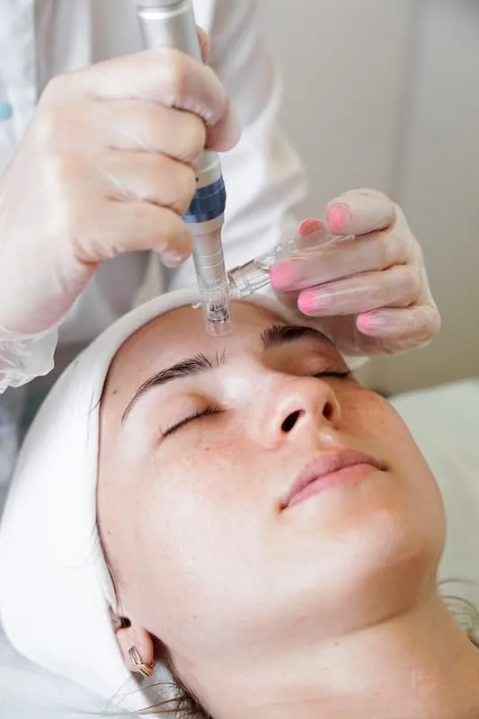 Face Microneedling