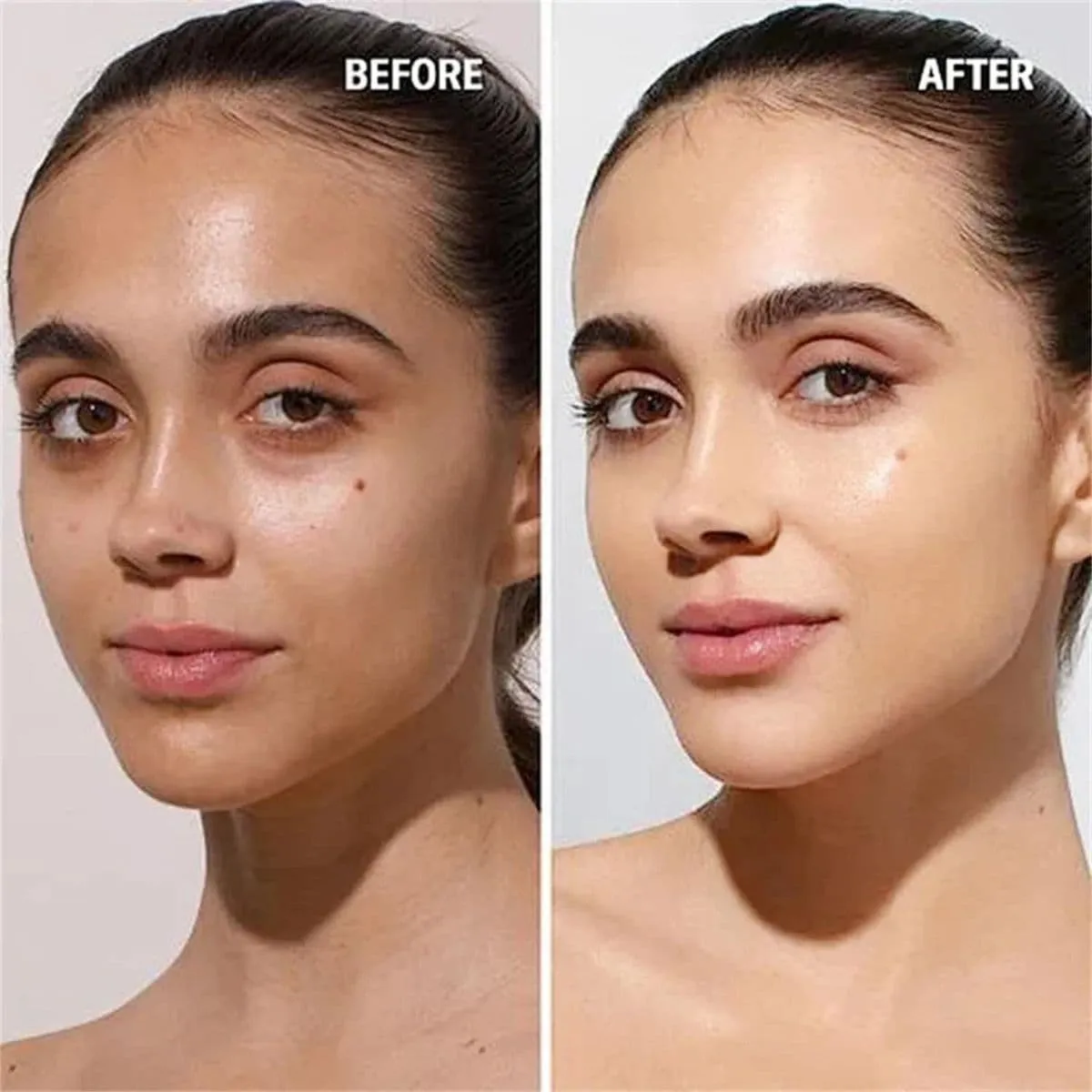 Skin Brightening